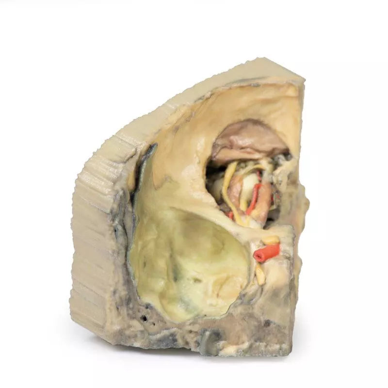 Erler-Zimmer Mediale Orbita