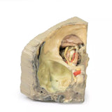 Erler-Zimmer Mediale Orbita