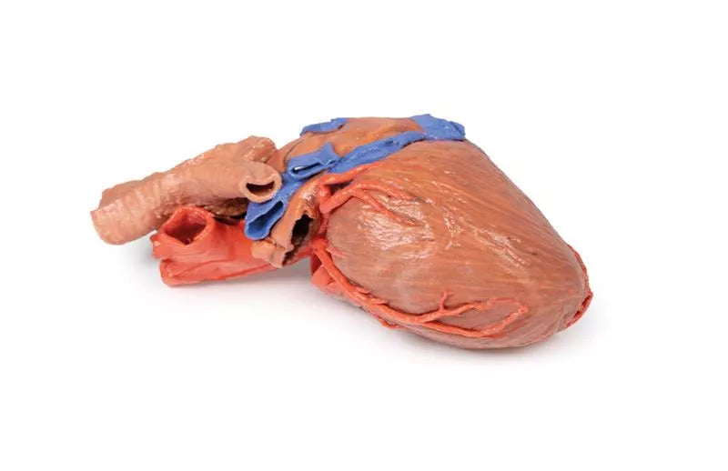 Erler-Zimmer Herz und distale Trachea, Carina tracheae und Primärbronchien