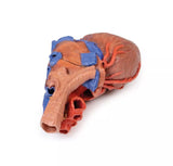 Erler-Zimmer Herz und distale Trachea, Carina tracheae und Primärbronchien