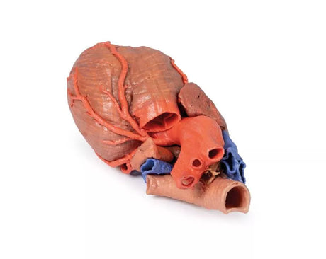 Erler-Zimmer Herz und distale Trachea, Carina tracheae und Primärbronchien