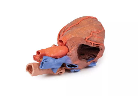 Erler-Zimmer Herz und distale Trachea, Carina tracheae und Primärbronchien