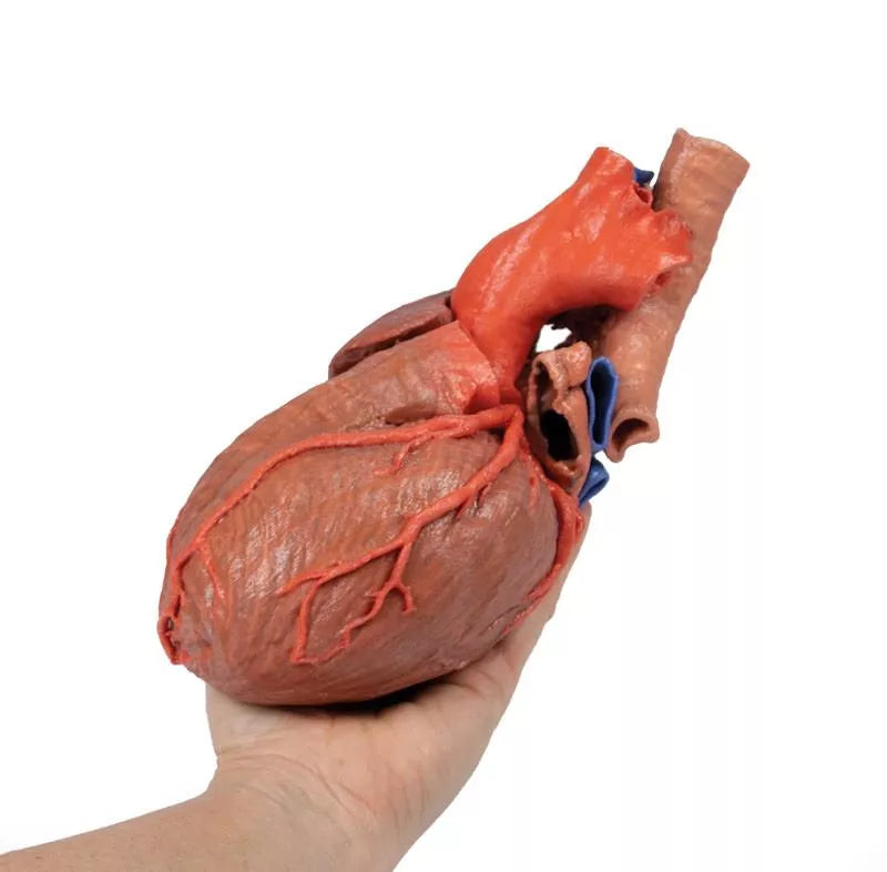 Erler-Zimmer Herz und distale Trachea, Carina tracheae und Primärbronchien