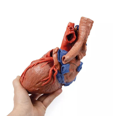 Erler-Zimmer Herz und distale Trachea, Carina tracheae und Primärbronchien