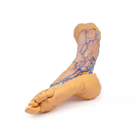 Erler-Zimmer Oberflächliche Venen der unteren Extremität