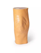 Erler-Zimmer Fossa poplitea