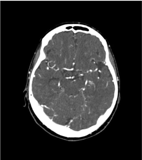 Erler-Zimmer Kopf und Hals Phantom für CT, Röntgen und Strahlentherapie