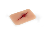 Erler-Zimmer Wundmoulage Schnittwunde