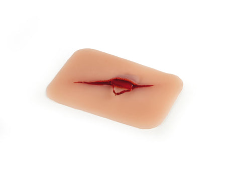 Erler-Zimmer Wundmoulage Schnittwunde