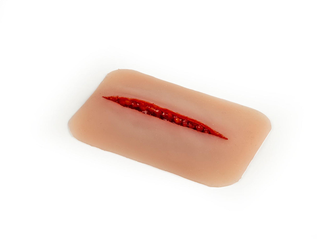 Erler-Zimmer Wundmoulage Schnittwunde