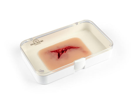 Erler-Zimmer Wundmoulage Risswunde