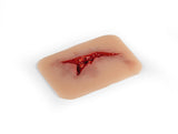 Erler-Zimmer Wundmoulage Risswunde