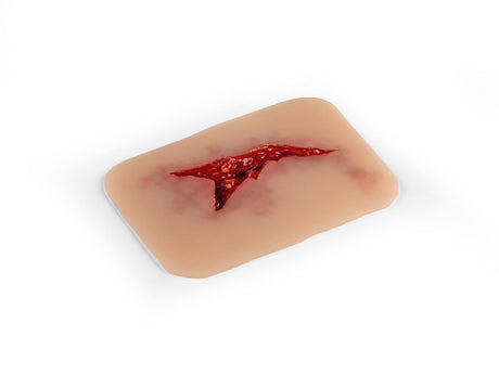 Erler-Zimmer Wundmoulage Risswunde