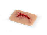 Erler-Zimmer Wundmoulage Risswunde