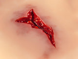 Erler-Zimmer Wundmoulage Risswunde