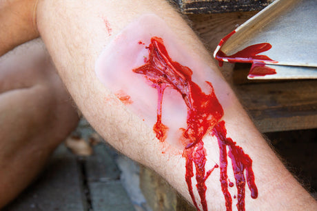 Erler-Zimmer Wundmoulage Risswunde