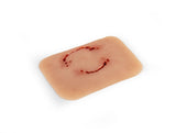 Erler-Zimmer Wundmoulage Bisswunde Mensch