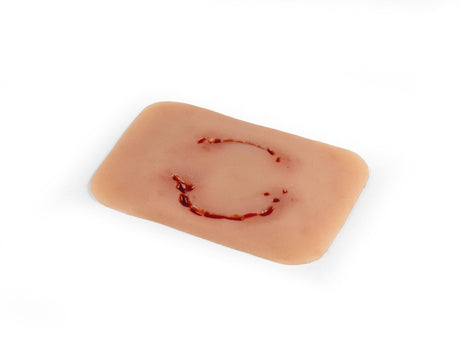 Erler-Zimmer Wundmoulage Bisswunde Mensch