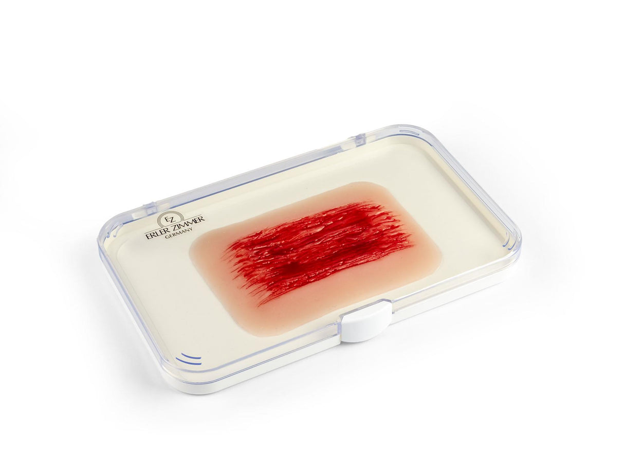 Erler-Zimmer Wundmoulage Schürfwunde