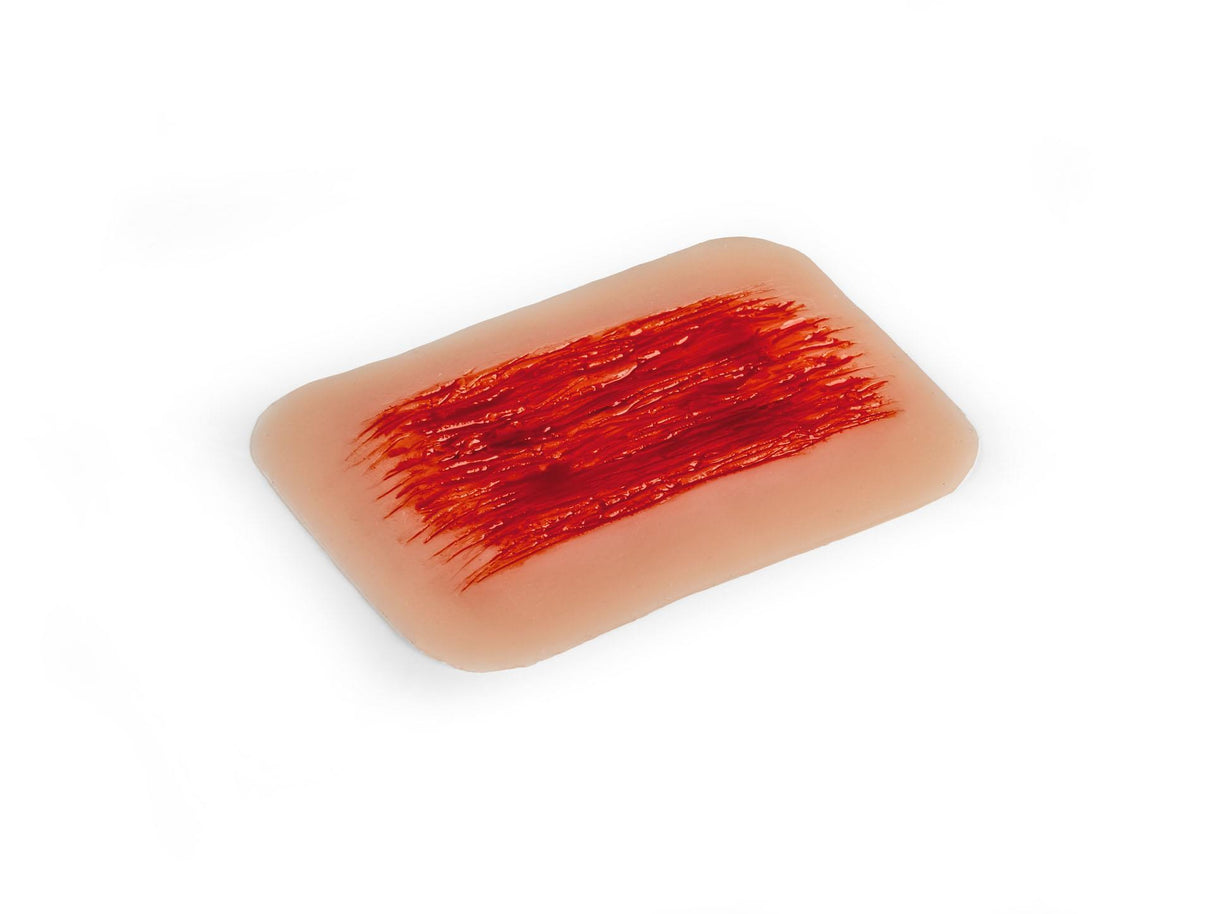 Erler-Zimmer Wundmoulage Schürfwunde