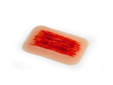 Erler-Zimmer Wundmoulage Schürfwunde
