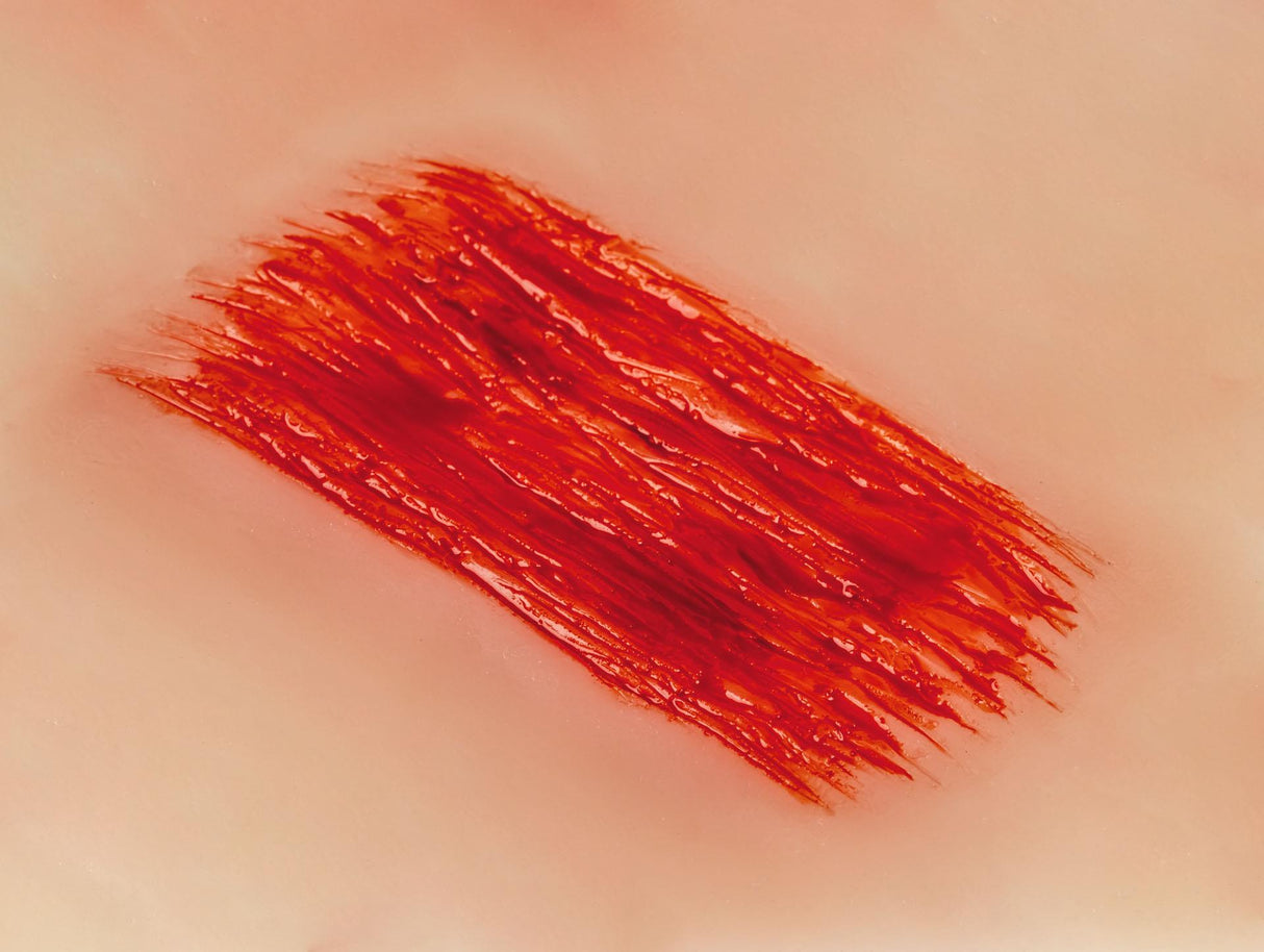Erler-Zimmer Wundmoulage Schürfwunde