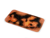 Erler-Zimmer Wundmoulage Brandwunde 2. Grades