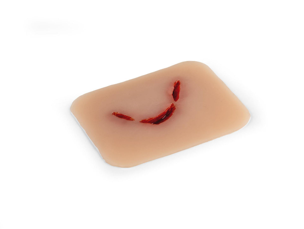 Erler-Zimmer Wundmoulage Schnittwunde