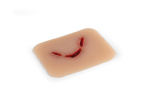 Erler-Zimmer Wundmoulage Schnittwunde