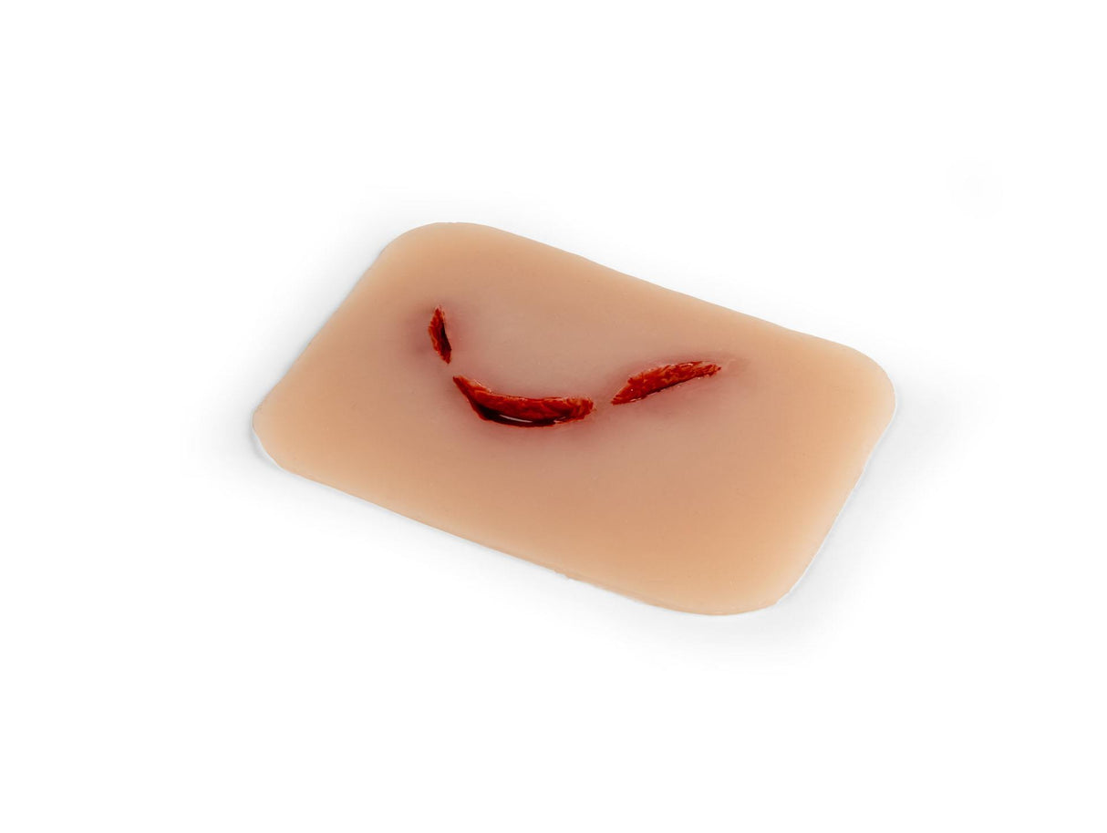 Erler-Zimmer Wundmoulage Schnittwunde