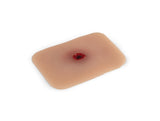 Erler-Zimmer Wundmoulage Einschußwunde