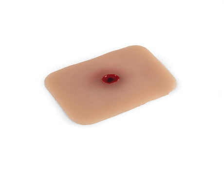 Erler-Zimmer Wundmoulage Einschußwunde