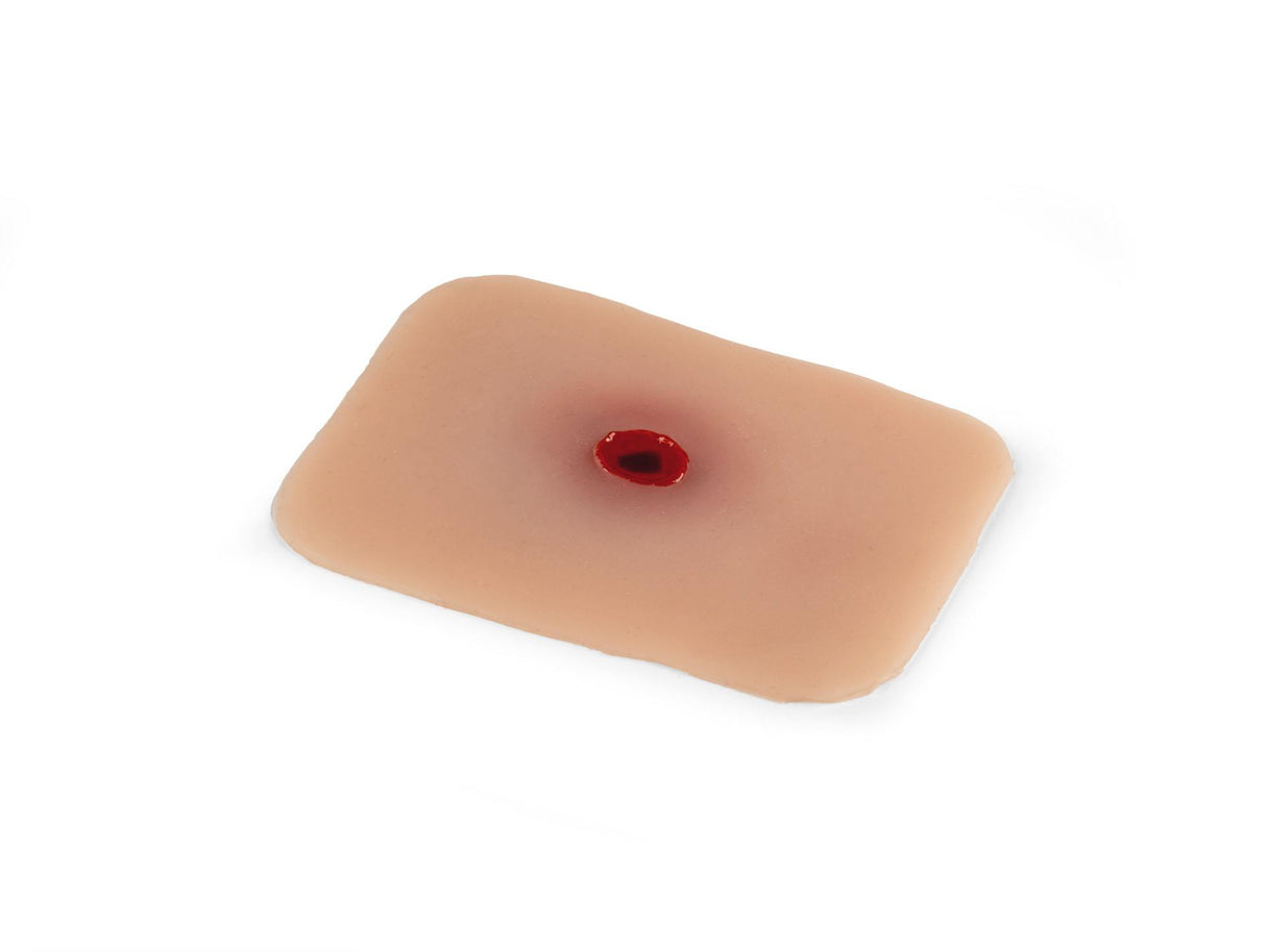 Erler-Zimmer Wundmoulage Einschußwunde