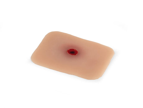 Erler-Zimmer Wundmoulage Einschußwunde