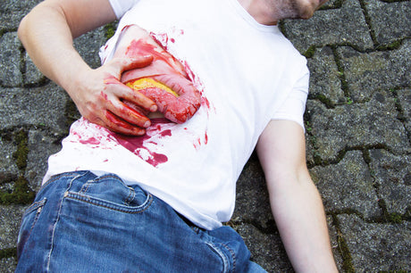 Erler-Zimmer Wundmoulage Dickdarmaustritt
