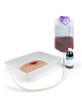 Erler-Zimmer Wundmoulage wound packing