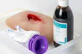 Erler-Zimmer Wundmoulage wound packing