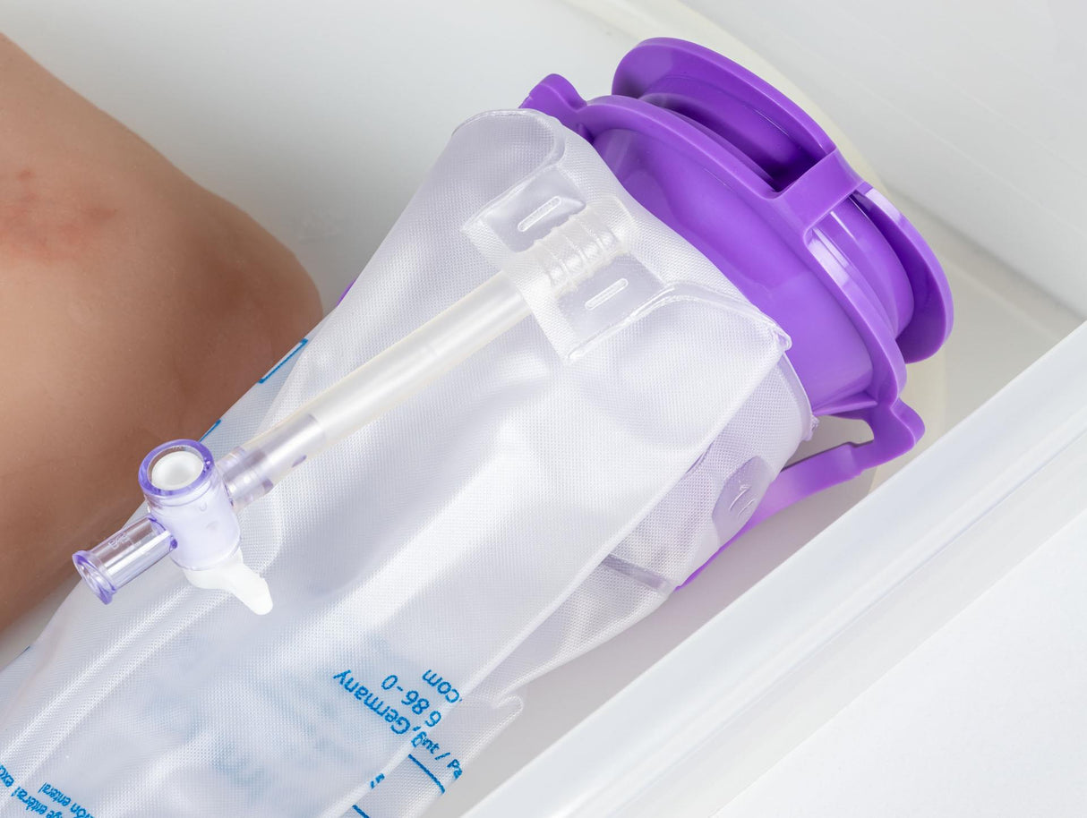 Erler-Zimmer Wundmoulage wound packing