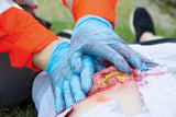 Erler-Zimmer Wundmoulage Dünndarmaustritt