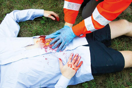 Erler-Zimmer Wundmoulage Dünndarmaustritt