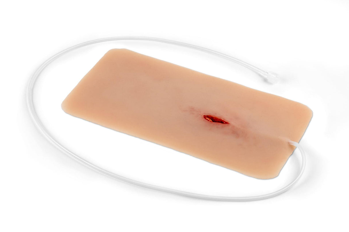 Erler-Zimmer Schnittwunde groß mit Blutungsfunktion