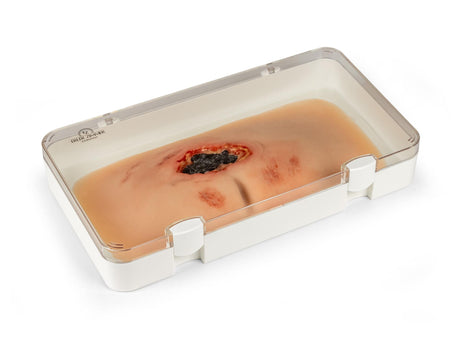 Erler-Zimmer Wundmoulage sakraler Dekubitus, gesäubert