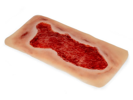 Erler-Zimmer Wundmoulage Ulcus Cruris Venosum, groß, Epithelisierungsphase