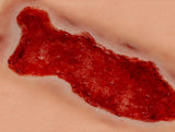 Erler-Zimmer Wundmoulage Ulcus Cruris Venosum, groß, Epithelisierungsphase