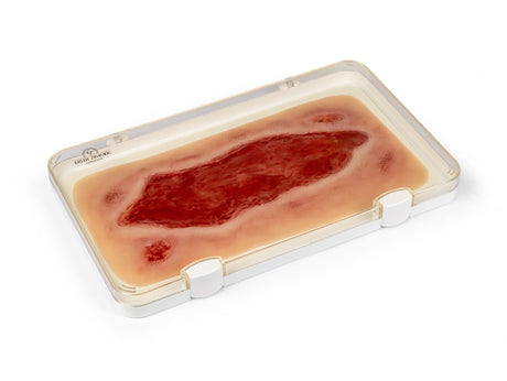 Erler-Zimmer Wundmoulage Ulcus Cruris Arteriosum, groß, Epithelisierungsphase
