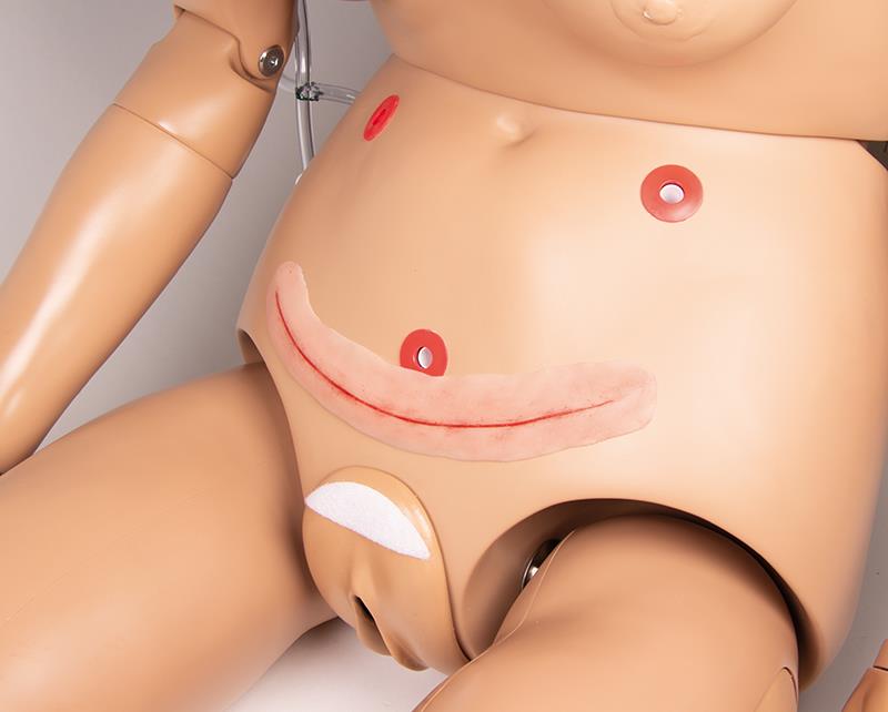 Erler-Zimmer OP Wunde, 22cm ohne Naht (zum Selbstnähen)