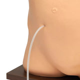 Erler-Zimmer Peritonealdialyse Simulator Modell