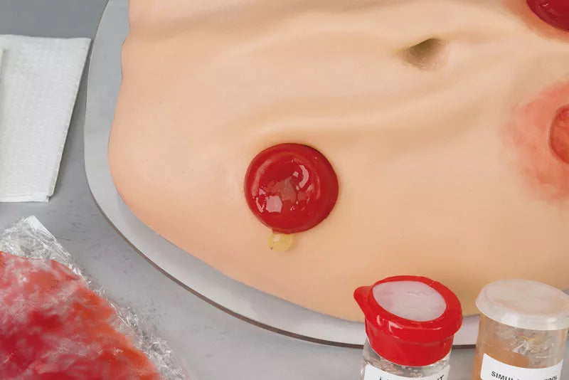 Erler-Zimmer Kompletter Stoma Simulator
