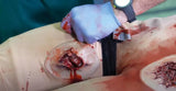 Erler-Zimmer Casualty Care Rescue Randy