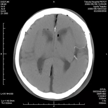 Erler-Zimmer Angiographie Kopfmodell